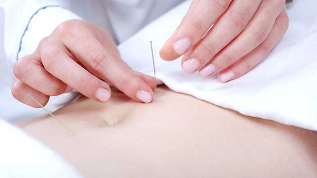 acupuncture infertilité